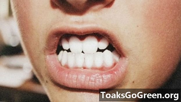 Что наши зубы говорят о нас