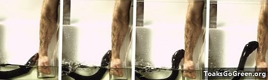 Zap! Biolog måler elektrisk ålsjokk på egen arm