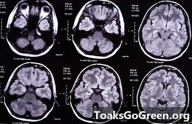 Skany CT ujawniają piękno, które jest więcej niż głębokie