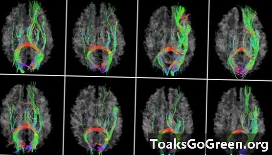 Novo mapa do cérebro localiza pontos de referência para memória, visão, linguagem e excitação
