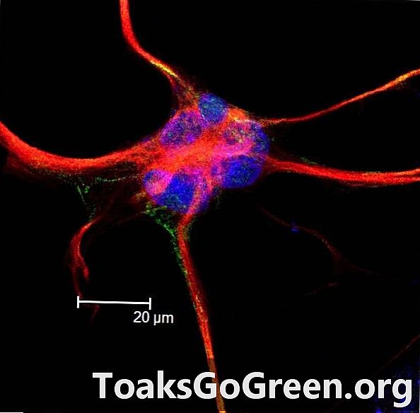Најчешћа ћелија људског мозга која се узгаја у лабораторијској јели