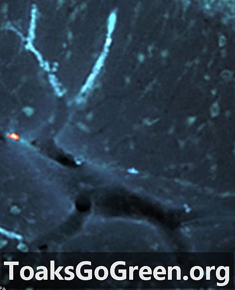 脳の血管の画像は、ルドルフの赤い鼻のトナカイのように見えます