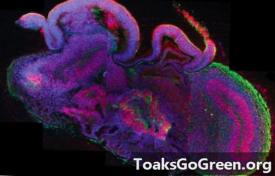 Wetenschappers creëren mini-menselijke hersenen in het lab