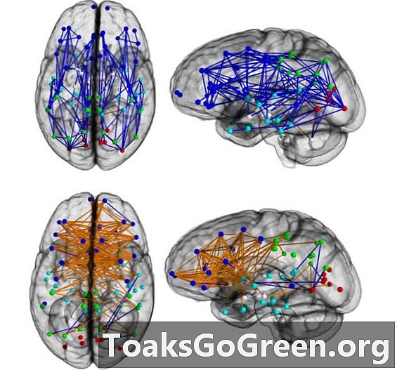 Поразителни разлики в мозъчното свързване между мъже и жени